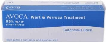 Avoca Wart Set